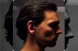 Alejandro Cano